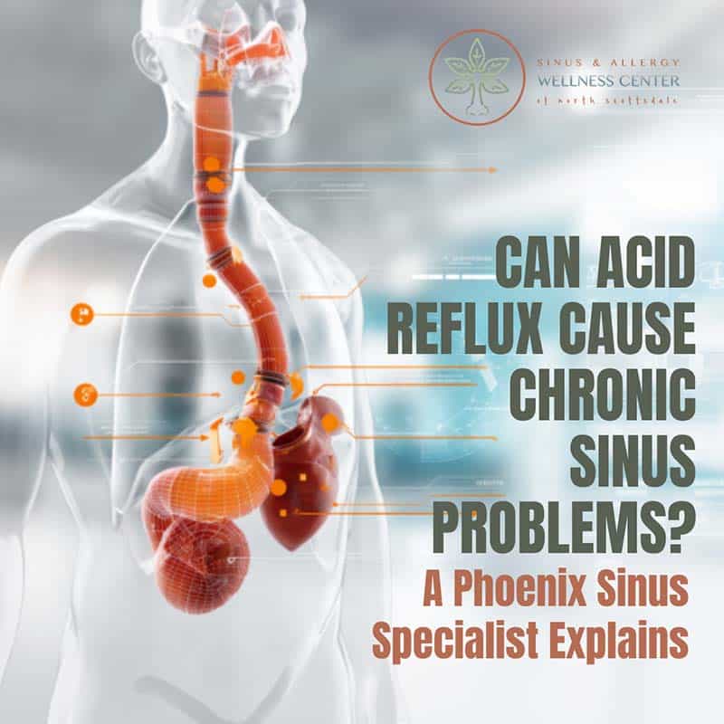 Can Acid Reflux Cause Chronic Sinus Problems? A Phoenix Sinus Specialist Explains